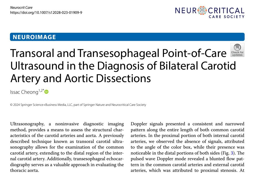 Transoral and Transesophageal Point-of-Care Ultrasound in the Diagnosis of Bilateral Carotid Artery and Aortic Dissections Neurocritical Care DOI 10.1007/s12028-023-01909-9 Sharelink: rdcu.be/dvuns #POCUS