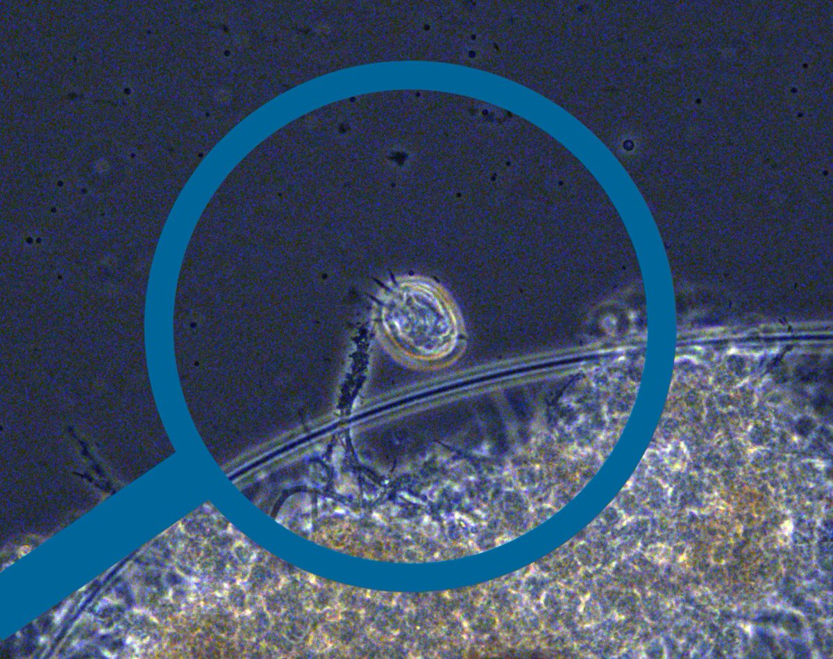 SaveWaterSB's tweet photo. Crawling ciliates are small protozoa named for “hairs” called cilia that enable the ciliates to climb over clumps of bacteria in search of food. Read more to learn how ciliates indicate healthy wastewater treatment and affect treatment performance.🔬https://t.co/K7vJGwVBrb https://t.co/8oCTxQ85MA