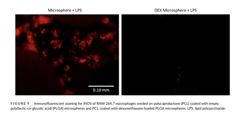 🆕Excited to be part of this work! A novel approach in treating tracheal stenosis with dexamethasone eluting polydopamine coated PCL-PLGA. doi.org/10.1002/jbm.a.…
