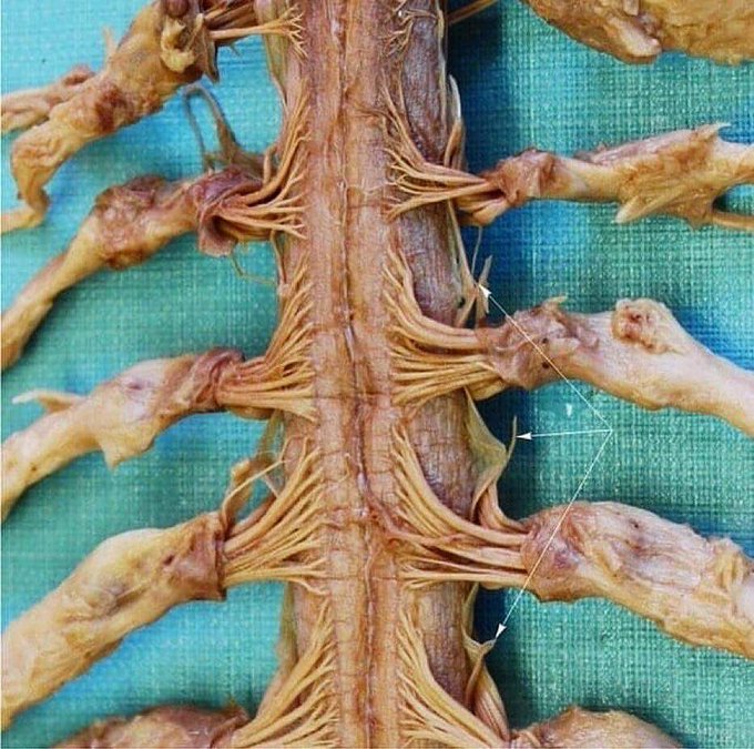 AxisCentro's tweet photo. Así es como se ven los nervios que salen de nuestra médula espinal. En total tenemos 31 pares de nervios espinales: 8 nervios cervicales, 12 nervios torácicos, 5 nervios lumbares, 5 nervios sacros  y 1 nervio coccígeo. https://t.co/gHNeFcG1no