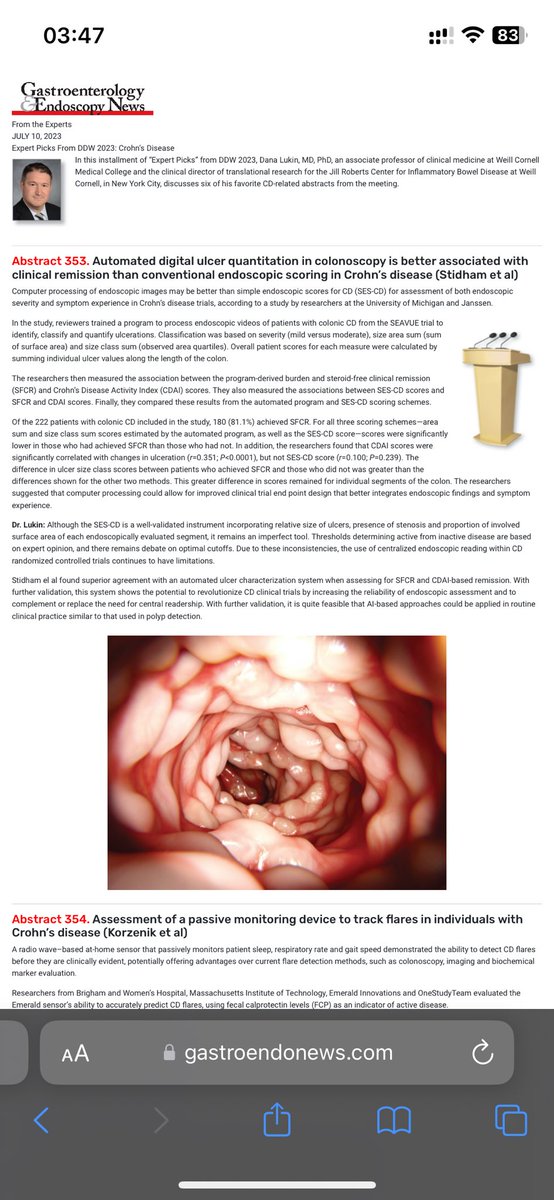 ShimaBehzad's tweet photo. @mendietaalex1 @NaffesaAlsheikh @BrownJHM @Jenmatos0 @drkeithsiau @DrMijailTapia @ManualOMedicine @docxusofficial Definitely Crohn’s 😒 https://t.co/Y2SYZzw7bu