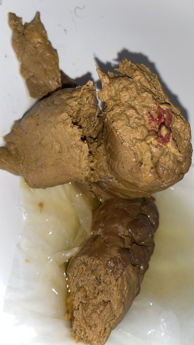 I1ovep00p's tweet photo. Took this shit and omg did it feel good coming out my tight hole #dump #faggotboy #gay #gayscat #horny #ilovepoop #kink #poop #porn #scat #shit #single https://t.co/RlGGnkWLsc