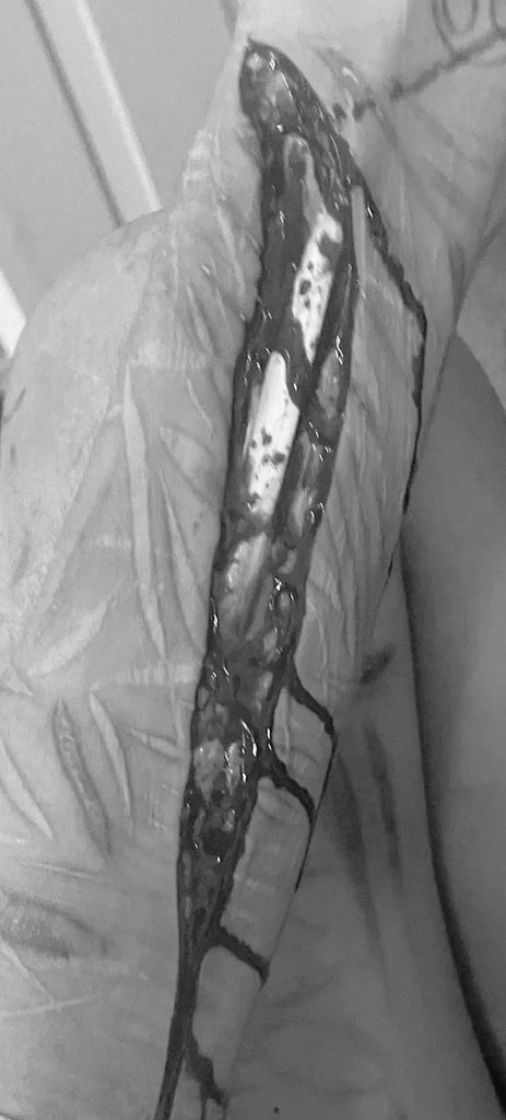 enpezando 🥺