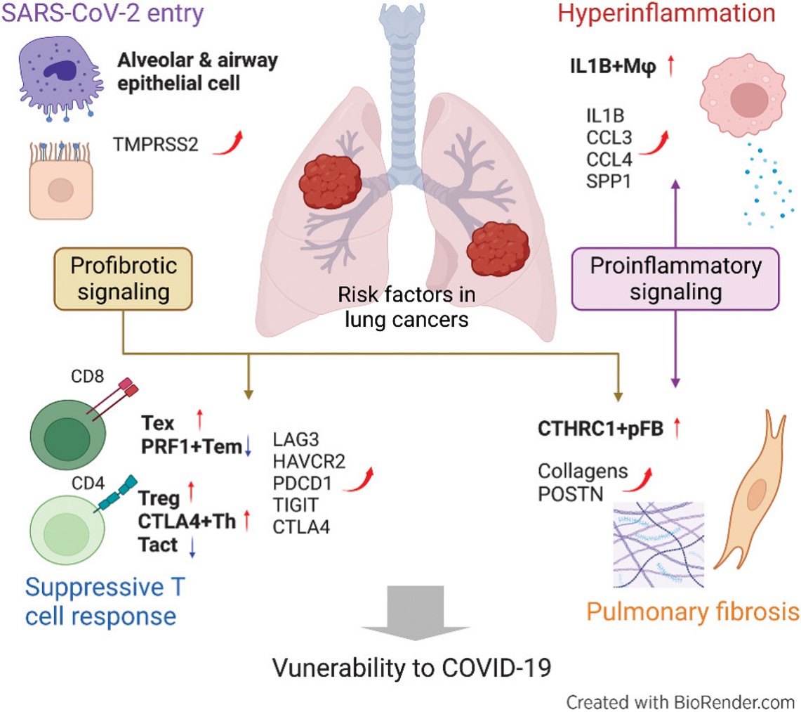 MCR_AACR's tweet image. #OnlineFirst: #SingleCellTranscriptomics reveals pre-existing COVID-19 vulnerability factors in #LungCancer patients, by Wendao Liu, @wli2019, and @zzhao_bioinfo.
bit.ly/41XvzPr
@MDAndersonNews @utsystem
