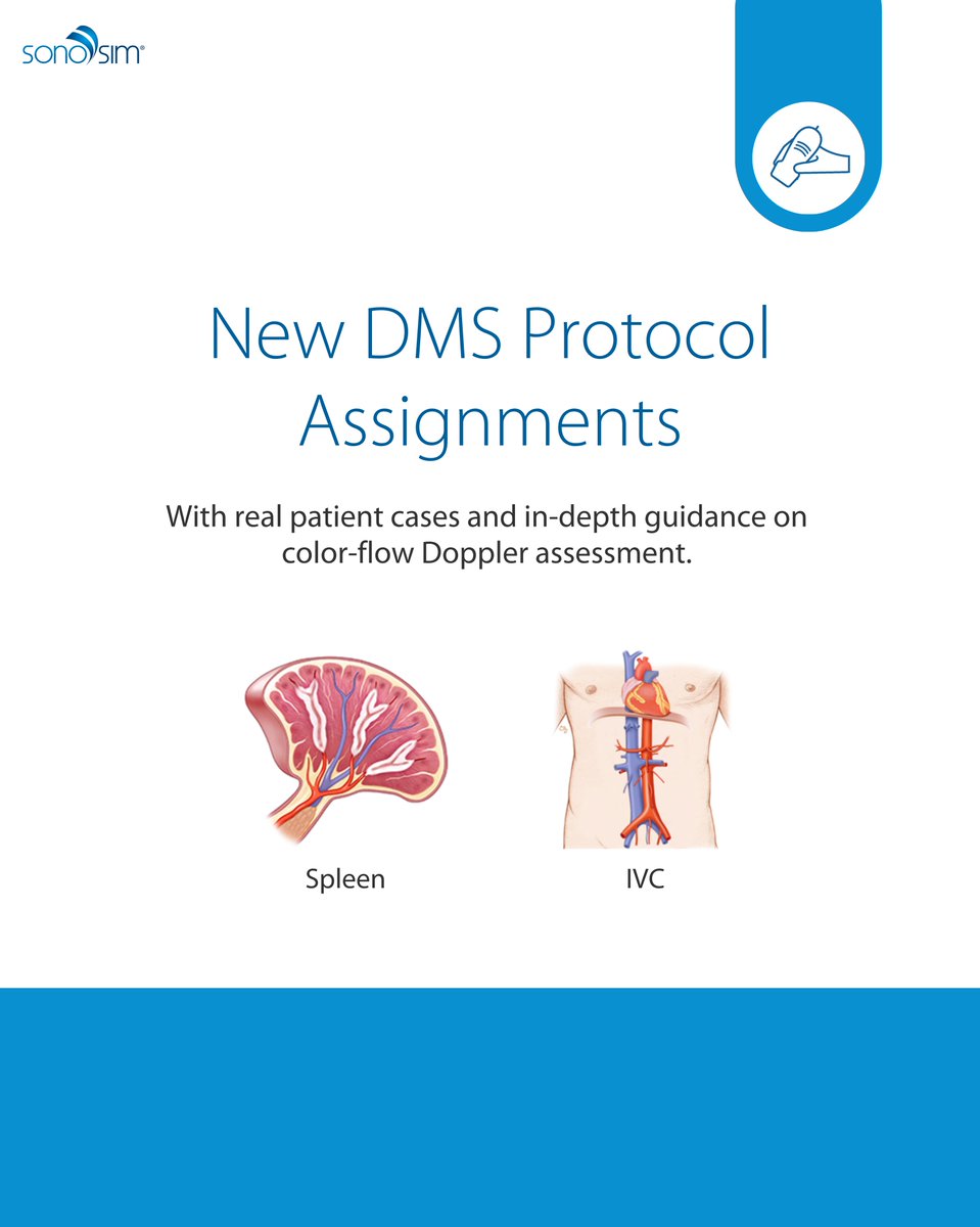 SonoSim's tweet photo. Hurray! We have two new SonoSim DMS Protocol Scanning Assignments. Give learners experience walking through Spleen and IVC ultrasound imaging protocols.
#ultrasoundtech #sonosim #sonographystudent #ultrasoundtraining https://t.co/DwLi1miS2o
