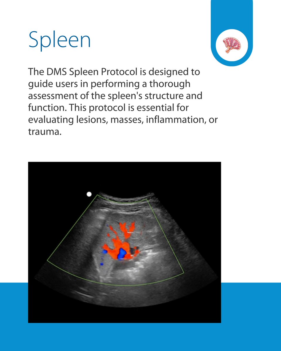 SonoSim's tweet photo. Hurray! We have two new SonoSim DMS Protocol Scanning Assignments. Give learners experience walking through Spleen and IVC ultrasound imaging protocols.
#ultrasoundtech #sonosim #sonographystudent #ultrasoundtraining https://t.co/DwLi1miS2o