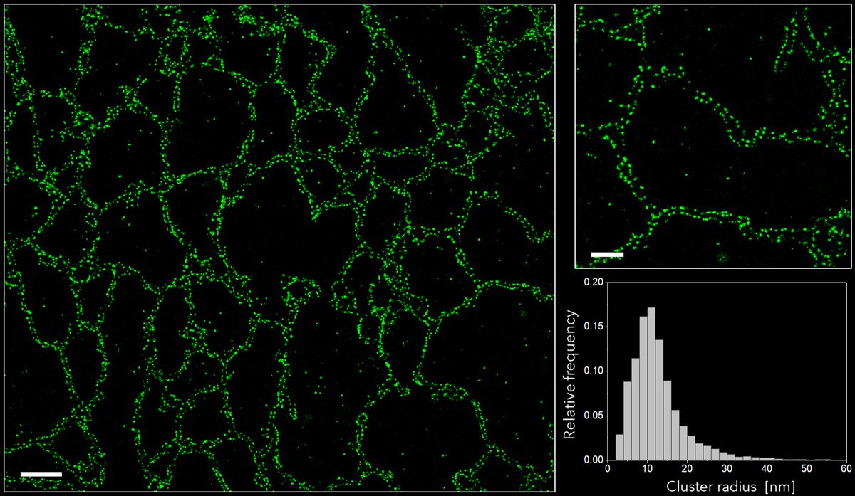 oniHQ's tweet photo. It's #FluorescenceFriday! Today we feature dSTORM images of the ER protein CLIMP-63 in COS7 cells, taken with the #Nanoimager and analyzed using the cloud-based software #CODI.
Scale bar is 2 µm for large image, 500 nm for small image.

#DiscoveryKit #superresolution #dSTORM https://t.co/AlF1LOdd7o
