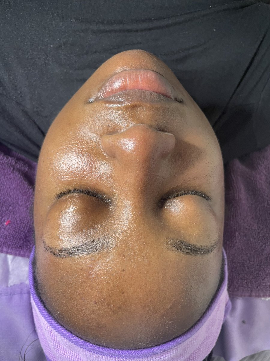 peaceofNayna's tweet photo. 1st facial in 2024, i haven’t done 1 in a while to be honest lol. but i still got it 😌
#skinPEACE by @_peaceofcolor https://t.co/XLqsCMqbTj