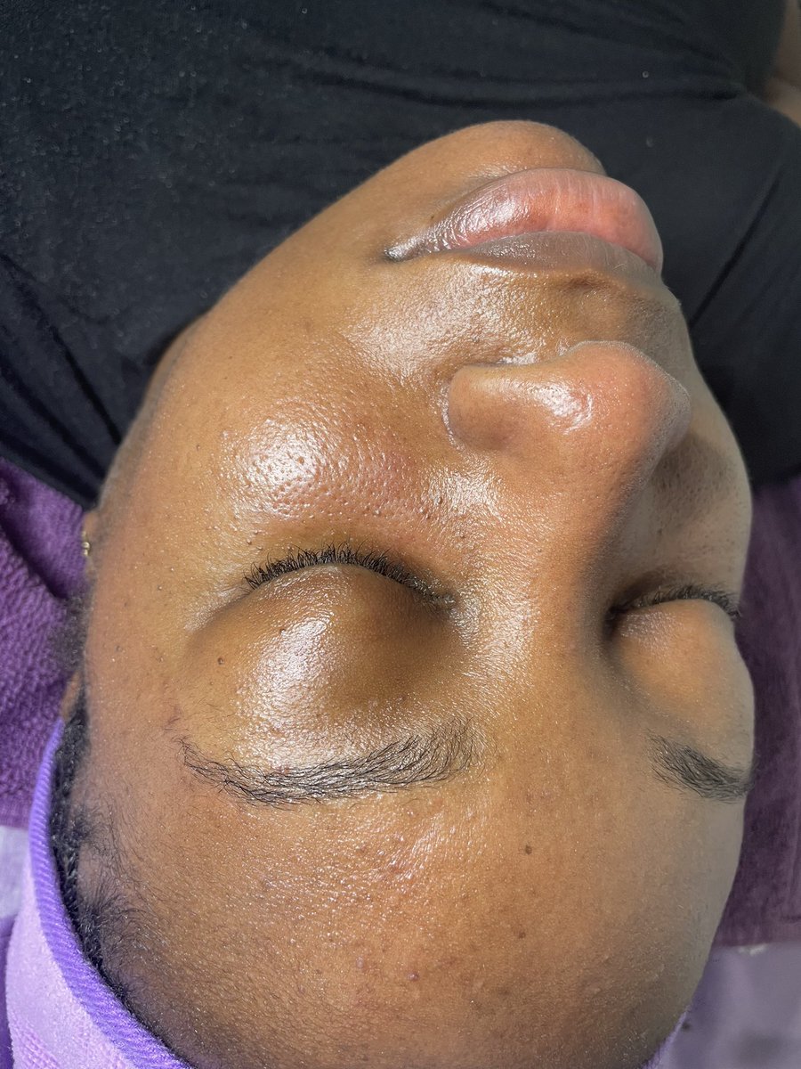 peaceofNayna's tweet photo. 1st facial in 2024, i haven’t done 1 in a while to be honest lol. but i still got it 😌
#skinPEACE by @_peaceofcolor https://t.co/XLqsCMqbTj