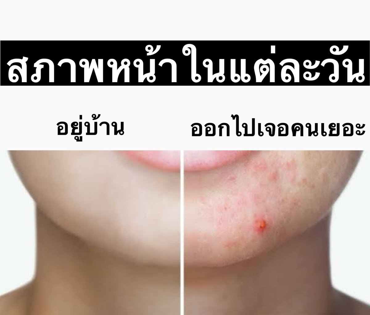 iTakkung's tweet photo. เหมือนฟ้าแกล้งกันให้ฉันต้องเสียความมั่นใจ #เซตนิพพานสิว https://t.co/Ju84rsOQdY