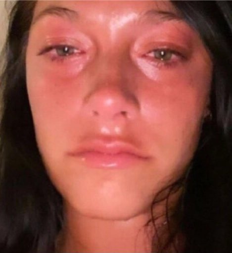 yo cuando una de las 40 chicas q le da like a mis historias no lo hace (quizás no salía tan bonita en la foto)