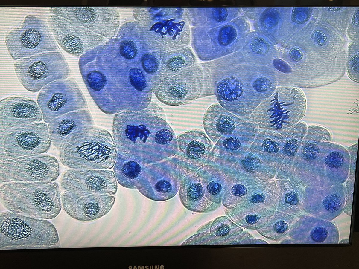 _Dawn_M's tweet image. Excellent morning with Julie and @lyndamicrobe and some fantastic students and staff from @ColtonHillsCS   Looking at the different stages of #mitosis in onion tip roots. #biology #microscopes