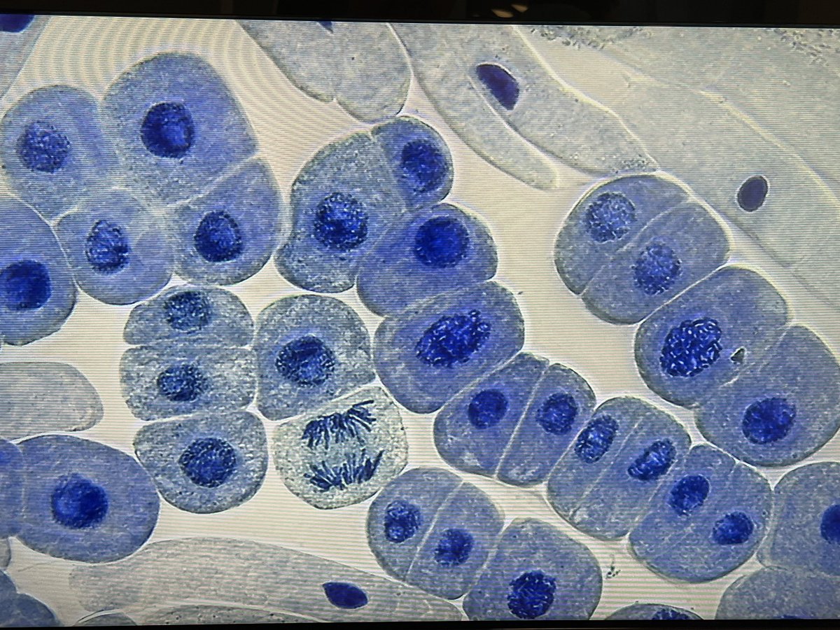 Excellent morning with Julie and @lyndamicrobe and some fantastic students and staff from <a href="/ColtonHillsCS/">Colton Hills Community School</a>   Looking at the different stages of #mitosis in onion tip roots. #biology #microscopes