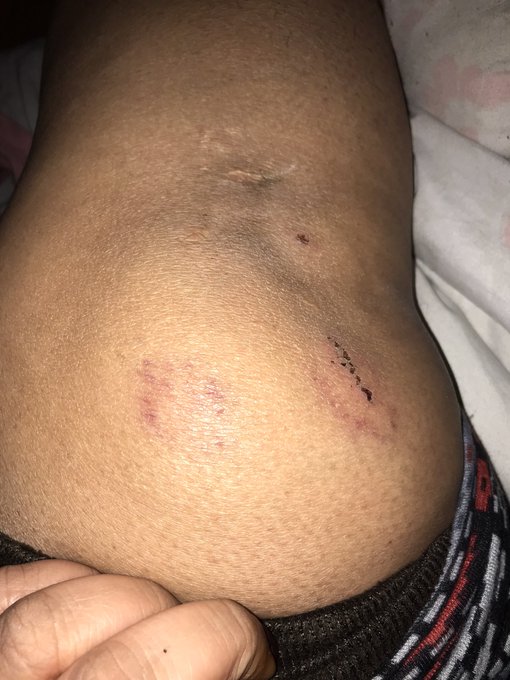 Seattle First Care Responders Saved my Life. They are my heroes. I am so grateful and I do not want to<a href="/tag/crazy"class="tags"><span>#crazy</span></a><a href="/tag/mentalillness"class="tags"><span>#mentalillness</span></a><a href="/tag/mentaldisorder"class="tags"><span>#mentaldisorder</span></a><a href="/tag/damsel"class="tags"><span>#damsel</span></a>