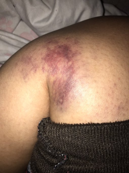 Seattle First Care Responders Saved my Life. They are my heroes. I am so grateful and I do not want to<a href="/tag/fashion"class="tags"><span>#fashion</span></a><a href="/tag/actress"class="tags"><span>#actress</span></a><a href="/tag/hollywood"class="tags"><span>#hollywood</span></a><a href="/tag/instagram"class="tags"><span>#instagram</span></a><a href="/tag/actor"class="tags"><span>#actor</span></a>