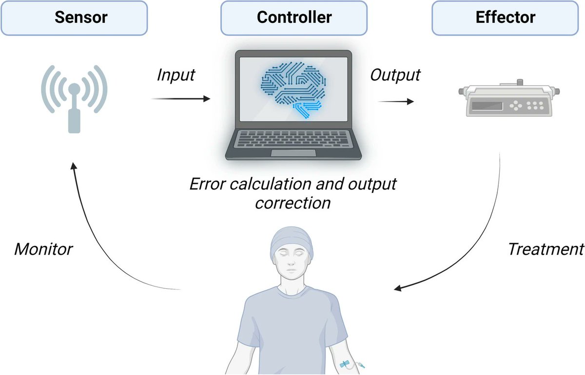 🤖🩺 Automating Anesthesia: Closed-Loop Systems Enhance Care: Better than manual control for stabilizing variables & reducing workload? by @SeanCoeck et al. from @UnivParisSaclay 🇫🇷 and @OutcomesRC 🇺🇸 link.springer.com/article/10.100… see our interview at: youtube.com/watch?v=zuj3B6…
