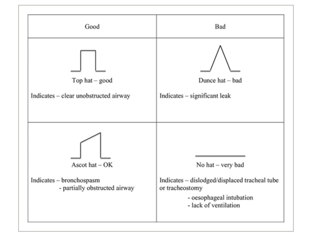 doctimcook's tweet photo. I think a key message is that 
-at the point of intubation
-for most non theatre settings
-including in neonatology

CAPNOGRAPHY is not a respiratory monitor.

CAPNOGRAPHY is an AIRWAY MONITOR

A positive upstroke on the capnograph shows we have alveolar ventilation (ie exhalation from alveoli engage in gas exchange). This requires a patent airway & gas flow.

It’s that simple.

For non anaesthetists
Don’t worry about the phases of the CO2 trace.
Do understand hats and caps