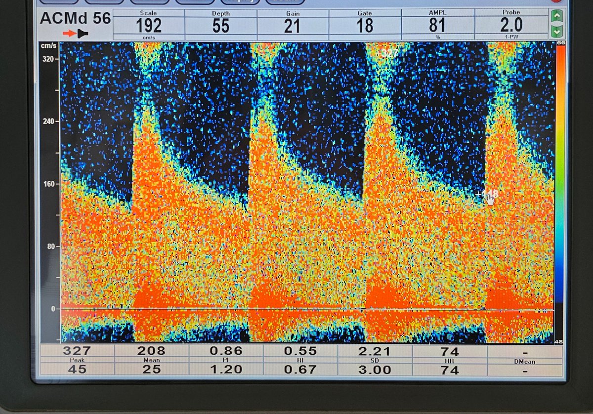 Neurosonology Lab - LHC tweet media