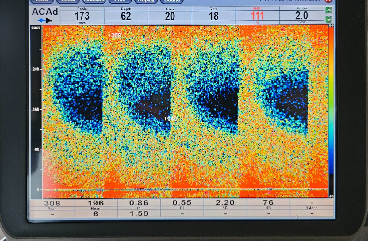 Neurosonology Lab - LHC tweet media