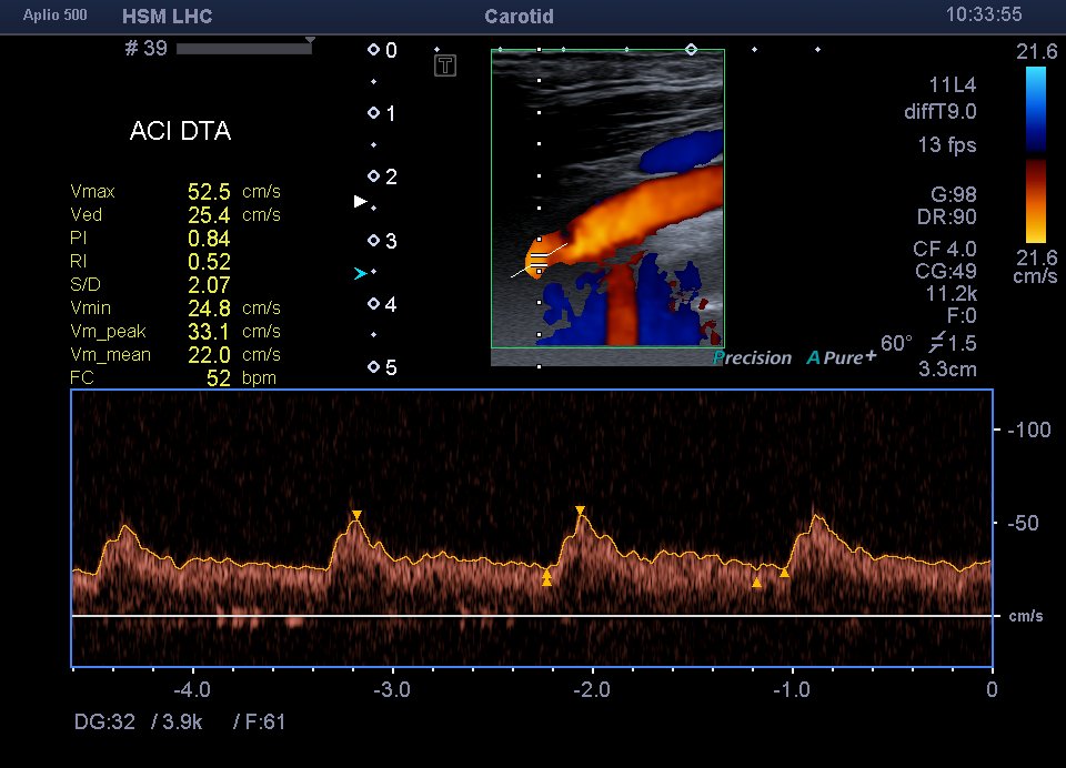 Neurosonology Lab - LHC tweet media