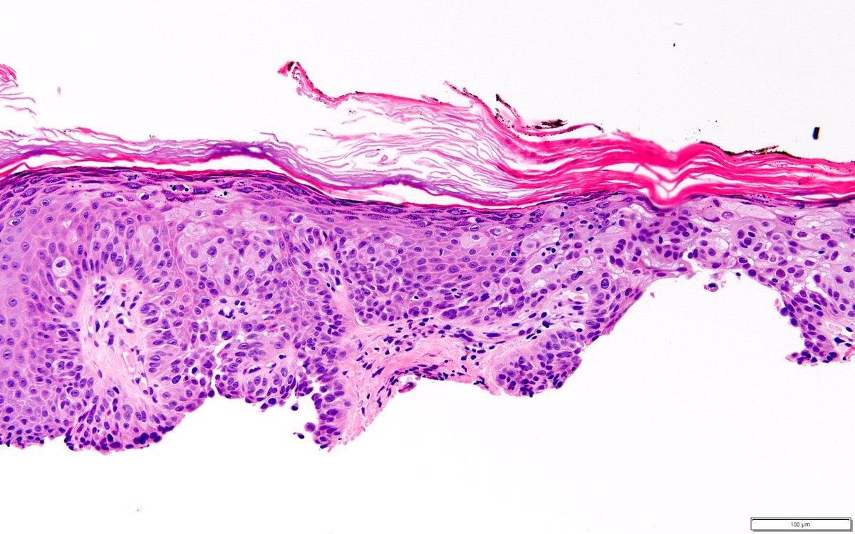 Dermpath-L tweet media