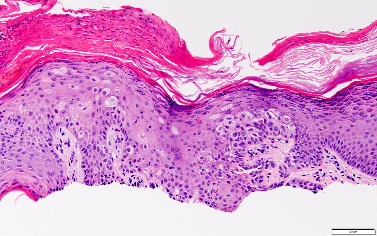 Dermpath-L tweet media