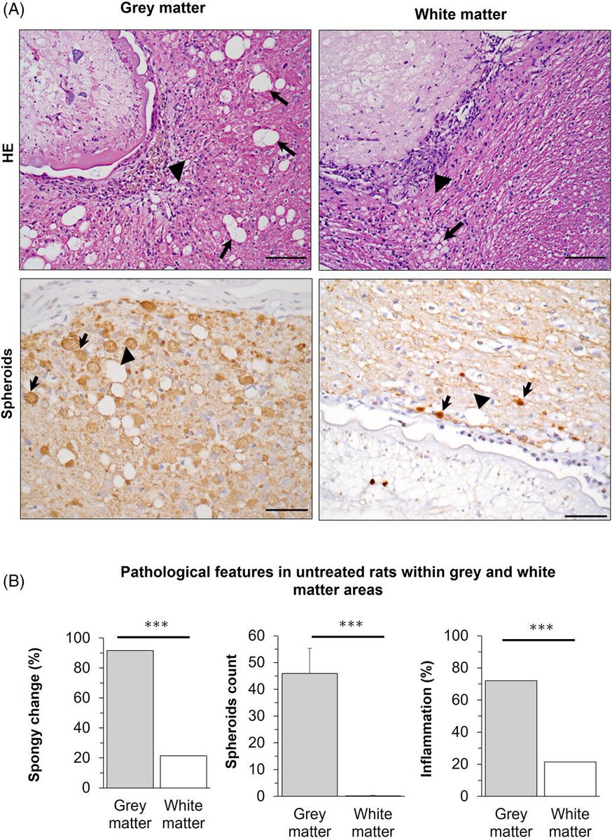 Brain Pathology tweet media