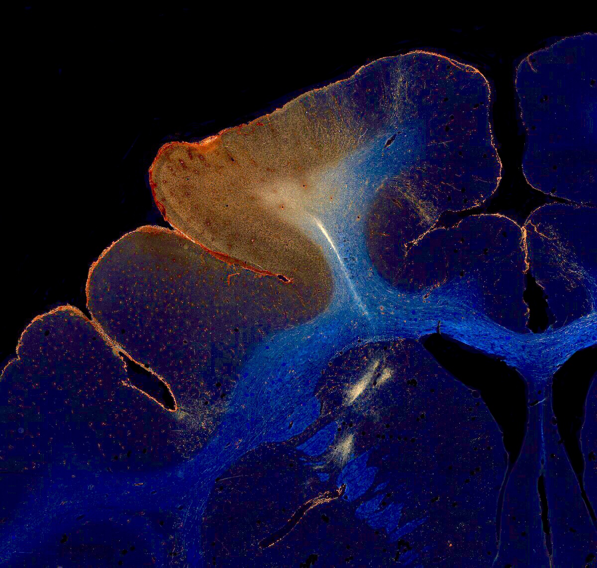 We are hiring - bigly. Join the computational team of our multi-institutional BRAIN Initiative comprehensive center that will produce first-ever maps of the wiring of the brain.

Tech: tinyurl.com/mrxymtc6
Coordinator: tinyurl.com/bdesd957
Postdoc: tinyurl.com/yckjy7xf