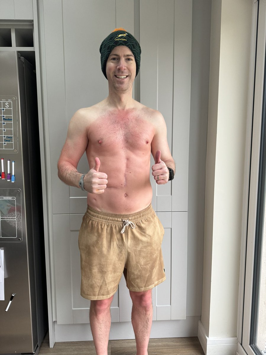 New to the ‘ice bathing’ world and from barely being able to stand in the bath 2 weeks ago, I’m feeling pretty chuffed that I managed 1 min 30s today! - Air temp: 1c & Water temp: 5c ..🥶 Definitely NOT at the stage where I would call this fun, it’s purely a mental challenge!