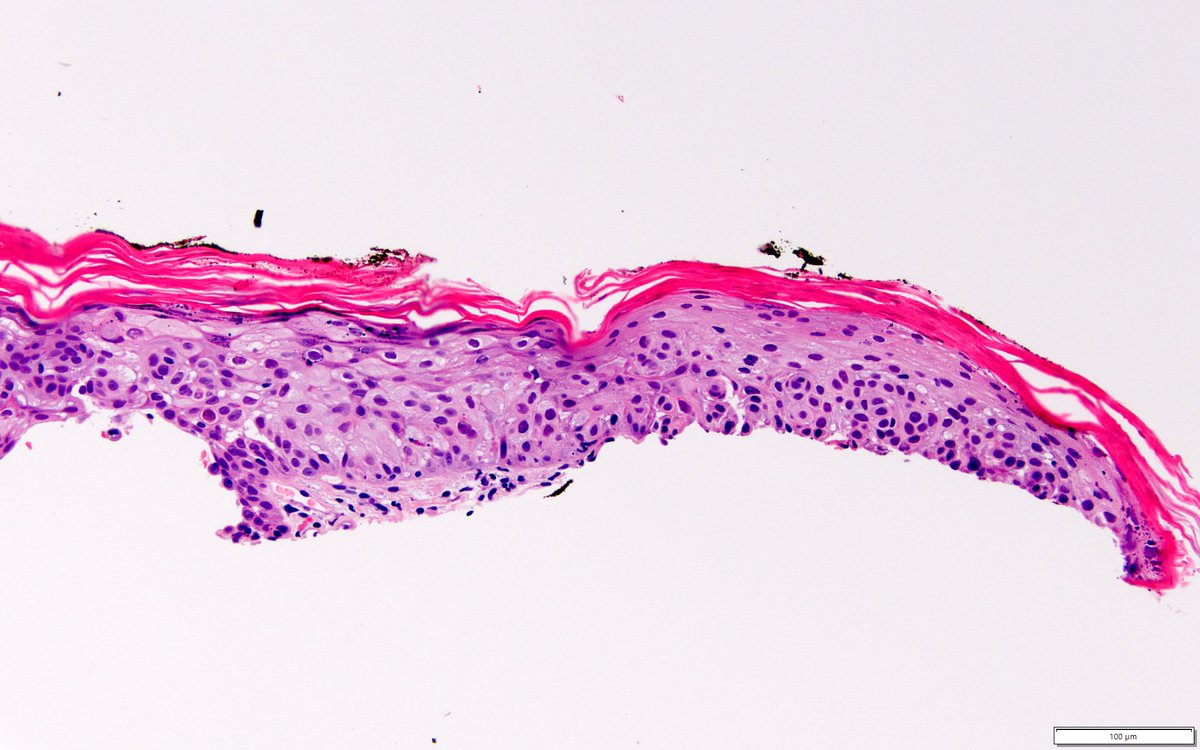 Dermpath-L tweet media