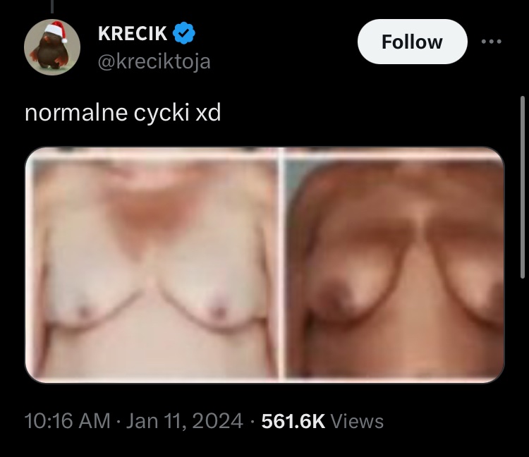 bingeshrex's tweet photo. Zauważyliście jak wielu chłopów mówi, że lubi „naturalne kobiety” a jak zobaczą naturalną kobietę, to są nagle obrzydzeni? https://t.co/WG5hKdZ3oX