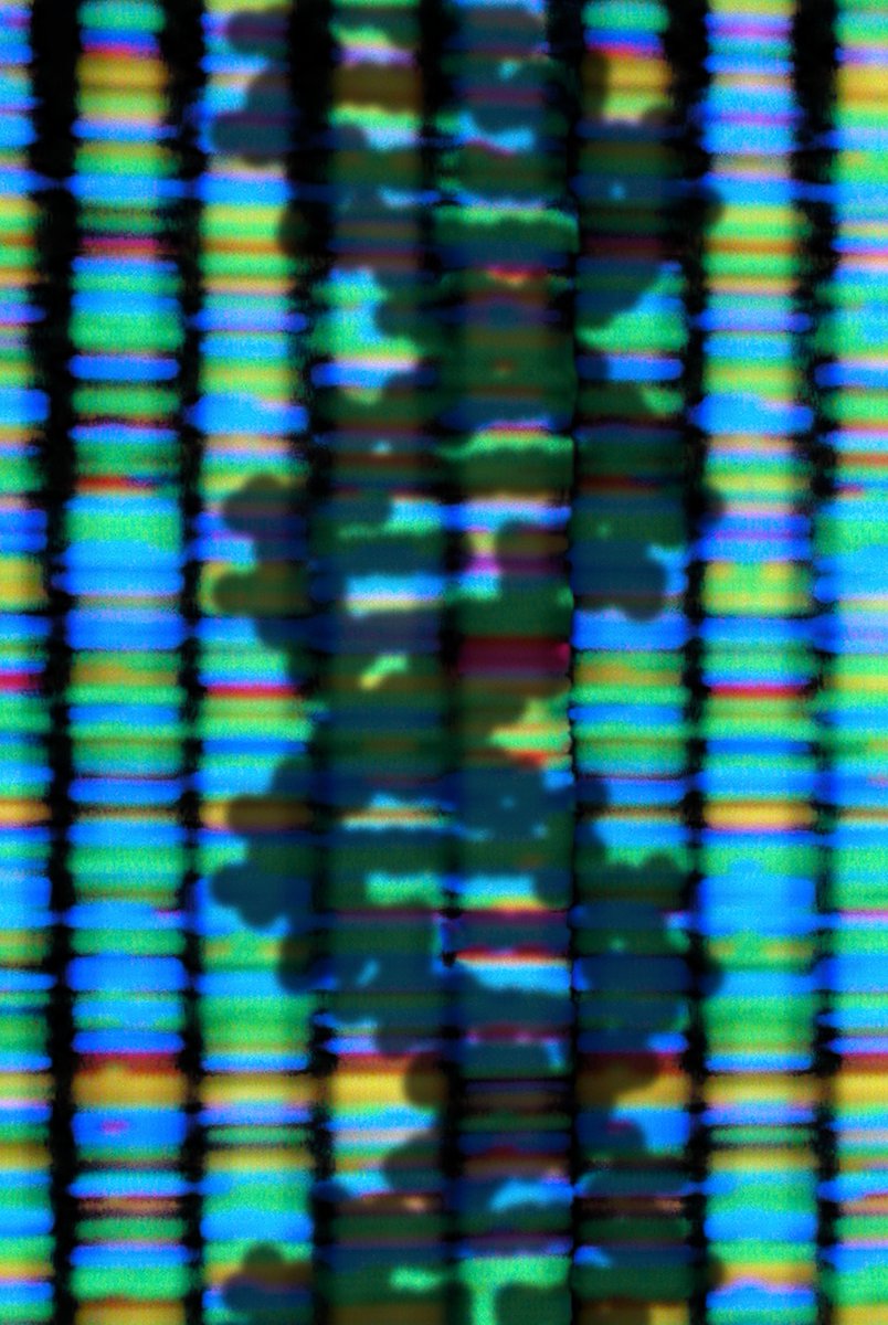 PET_BioNews's tweet photo. A new gene therapy has been successfully tested in mice that could provide an alternative to surgery in children with drug resistant epilepsy
Dr Jenny Lange writes more about this new therapy in BioNews
https://t.co/xlTlzLqjtG
#GeneTherapy #Genomics #EpilepsyAwareness #epilespy https://t.co/BffRNJpn5c