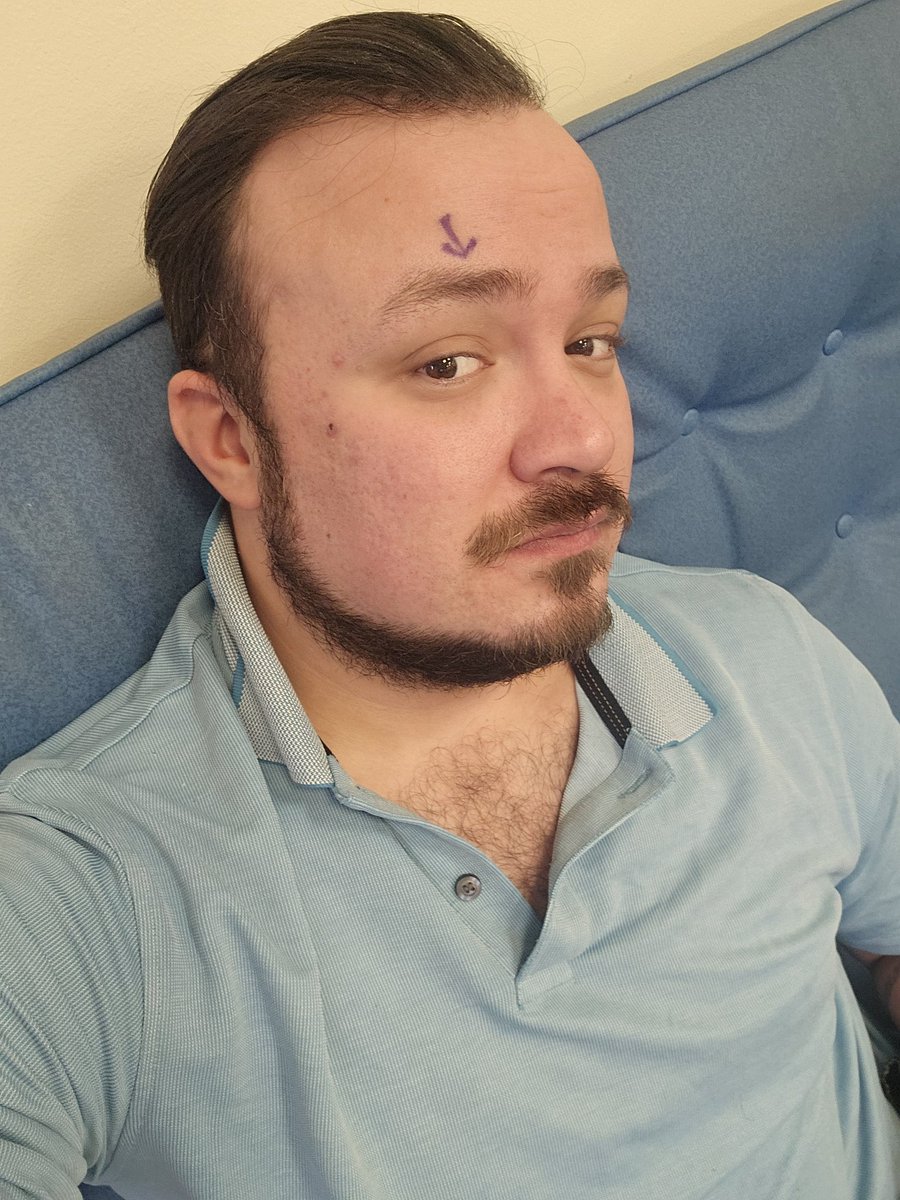 ryancolin1995's tweet photo. Let's hope this all heals up before seeing @Yfielding, @realkarlbeattie and company on the 16th !!!! #Mosthaunted #Mosthauntedstageshow https://t.co/DXeKTg20tM
