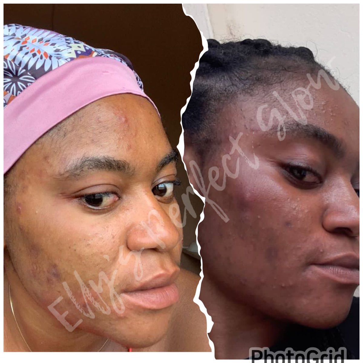 EllysPerfect's tweet photo. We're adding a little glow to your day with our wide selection of beauty products! 🌟
Shop with us Now💇💄

#IndeceAkwaabaFest24 #DSTV #YOLO #JUNKATOWN  #TheUniversityChallenge #NoGreeForAnybody #Balloon #AFCON #BlackStars #Ghana #interestingfacts #GhostEncounters https://t.co/za2ZeO5h9D