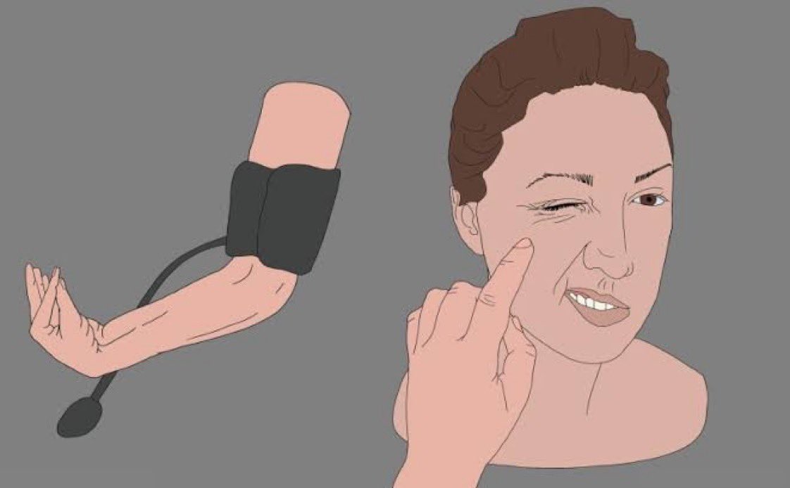 Name the clinical sign ?

What’s the cause ?