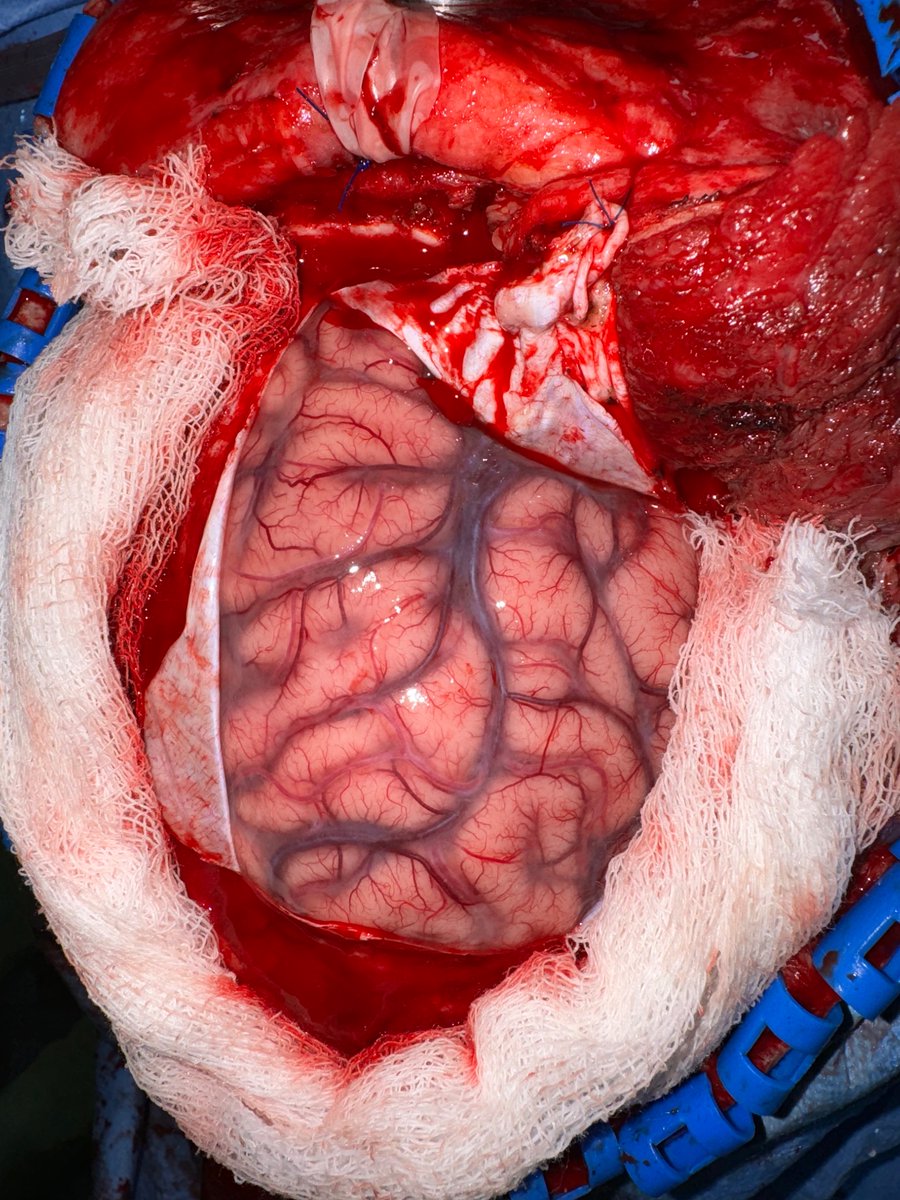 Have you ever seen Brain ? 
🧠 
See how beautiful it looks
Gods near perfect creation 
See the beautiful vessels arteries and veins .
