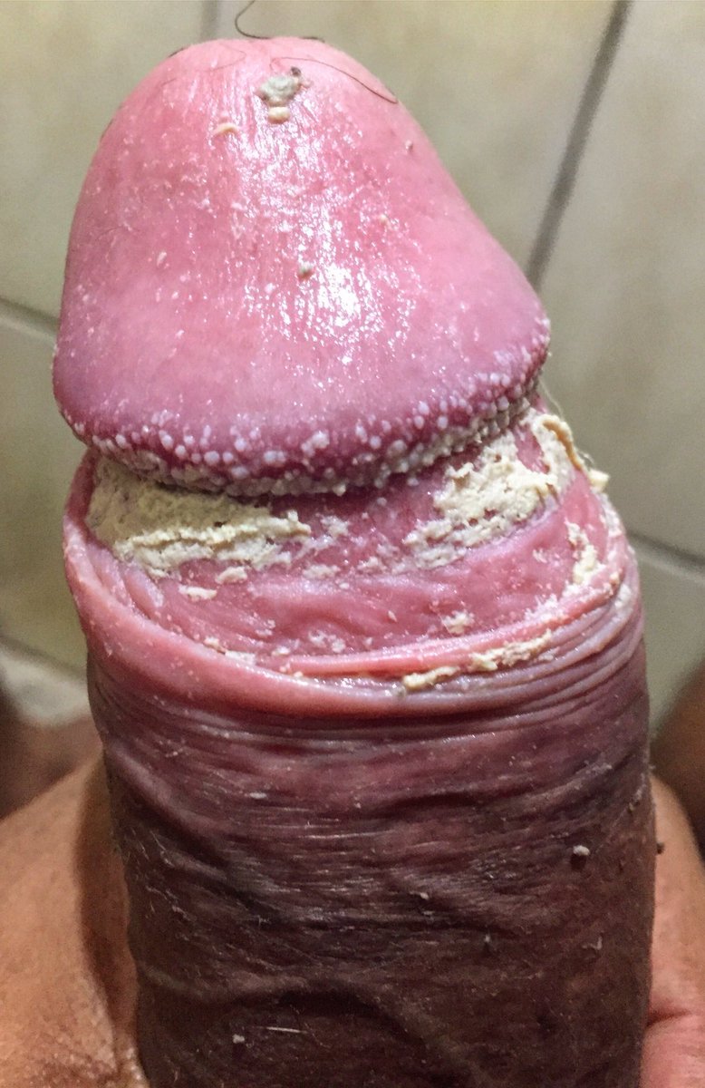 razeesoba's tweet photo. 👇😭😭😫🐽🧀🤮😩👅👅👅😩👇😭😭🧀🧀🧀
More filthy cock cheese and smegma on my OF 👇👇

https://t.co/xjuot4Dxhr https://t.co/2Scl1RbBRR
