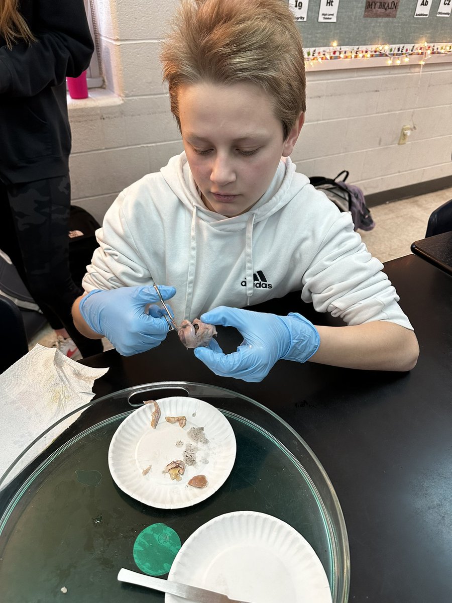 2nd hour exploring eyeballs!