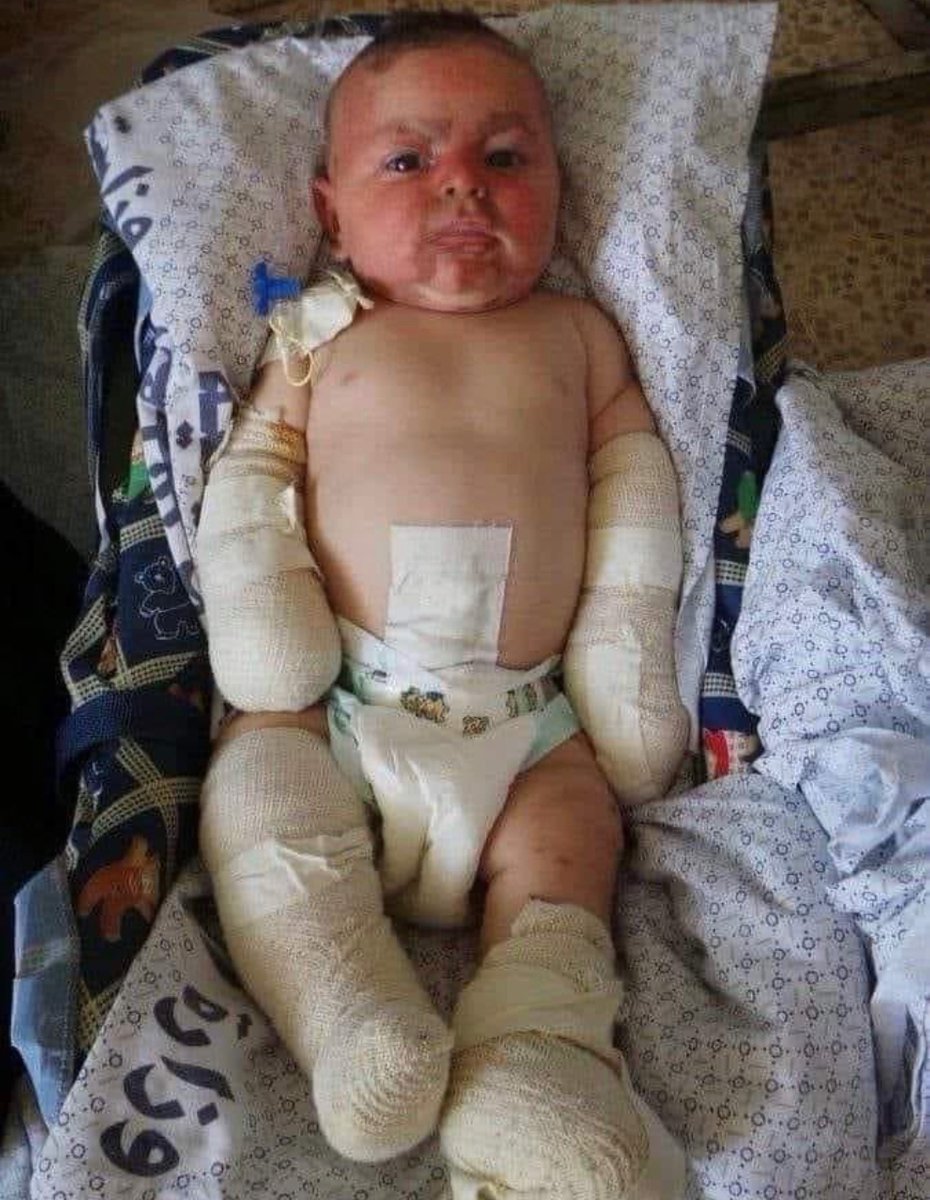 ShaykhSulaiman's tweet image. BABIES ARE BEING TARGETED