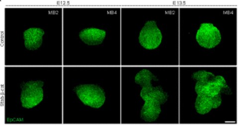 Mammary Cell News (@mammarycell) on Twitter photo Scientists at <a href="/HiLIFE_helsinki/">HiLIFE_Helsinki</a> reported a strong 📉 downregulation of epithelial Wnt/β-catenin activity as the #mammary bud progresses to branching.
They showed that ⚡ forced activation compromises #embryonic mammary gland branching.
<a href="/theJIDJournal/">Journal of Investigative Dermatology</a> | bit.ly/3TSnD07 Scientists at <a href="/HiLIFE_helsinki/">HiLIFE_Helsinki</a> reported a strong 📉 downregulation of epithelial Wnt/β-catenin activity as the #mammary bud progresses to branching.
They showed that ⚡ forced activation compromises #embryonic mammary gland branching.
<a href="/theJIDJournal/">Journal of Investigative Dermatology</a> | bit.ly/3TSnD07