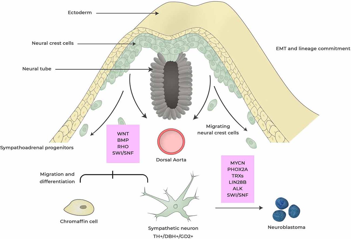 Neuroblastoma development from neural crest. What can you share about it? Credits: Johnsen JI, Dyberg C and Wickström M #MedTwitter