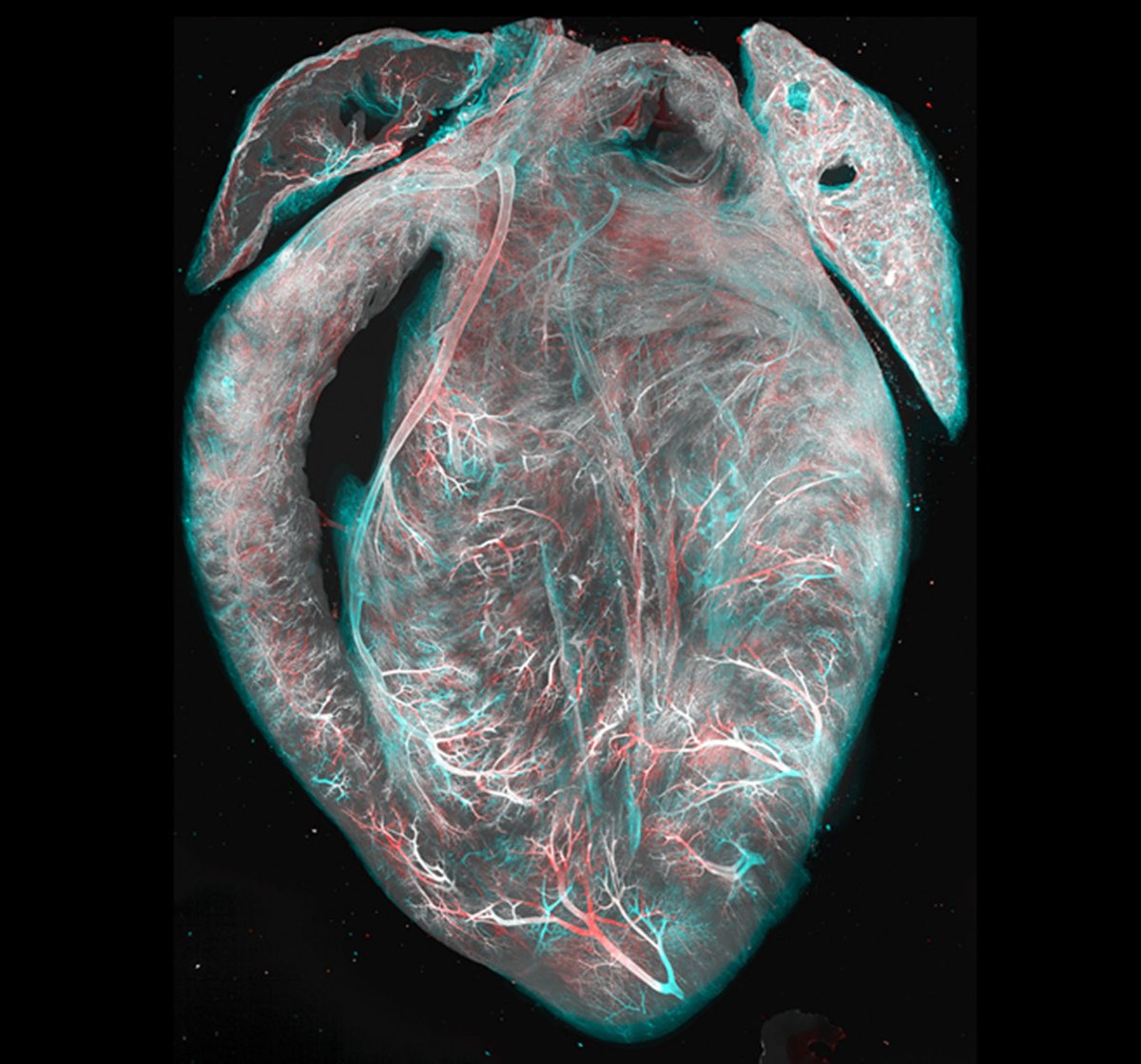 The cleared mouse heart . The blood vessels are labeled with perfused lectin and processed with tissue clearing protocol EZ Clear to render the whole heart optically transparent for imaging. Credits: Dr. Chih-Wei Logan Hsu #MedTwitter