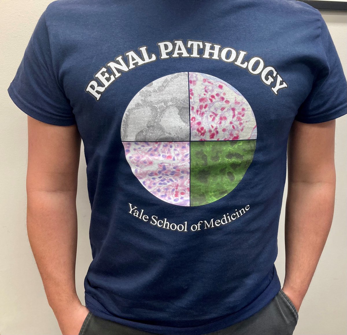 yalepathology's tweet photo. Our #Renal #Pathology &amp; Electron Microscopy Lab Team @YaleMed, led by @gilthepil, models a new T-shirt designed by Lab Manager Sara Pawlak. The shirts also feature their names on the back (it must be playoff season). Known internationally, the lab processes 1,200+ specimens/year. https://t.co/feHR2QjWax