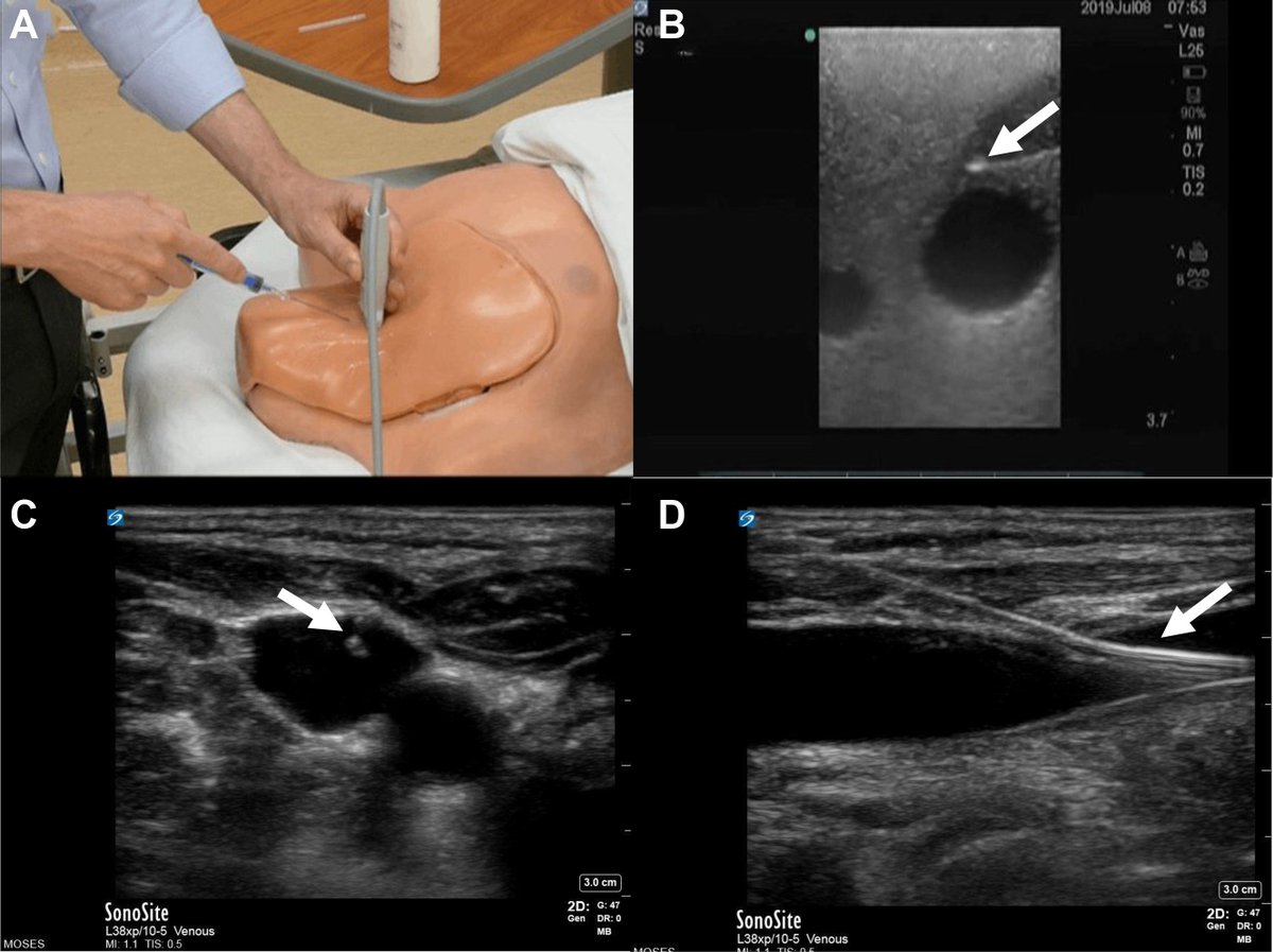 NephroPOCUS tweet media