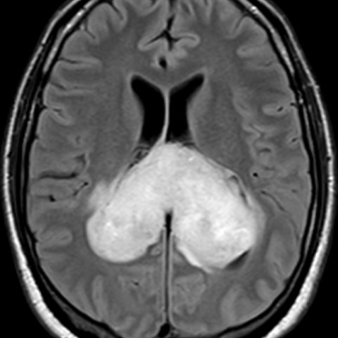 What is the Near Fatal diagnosis?