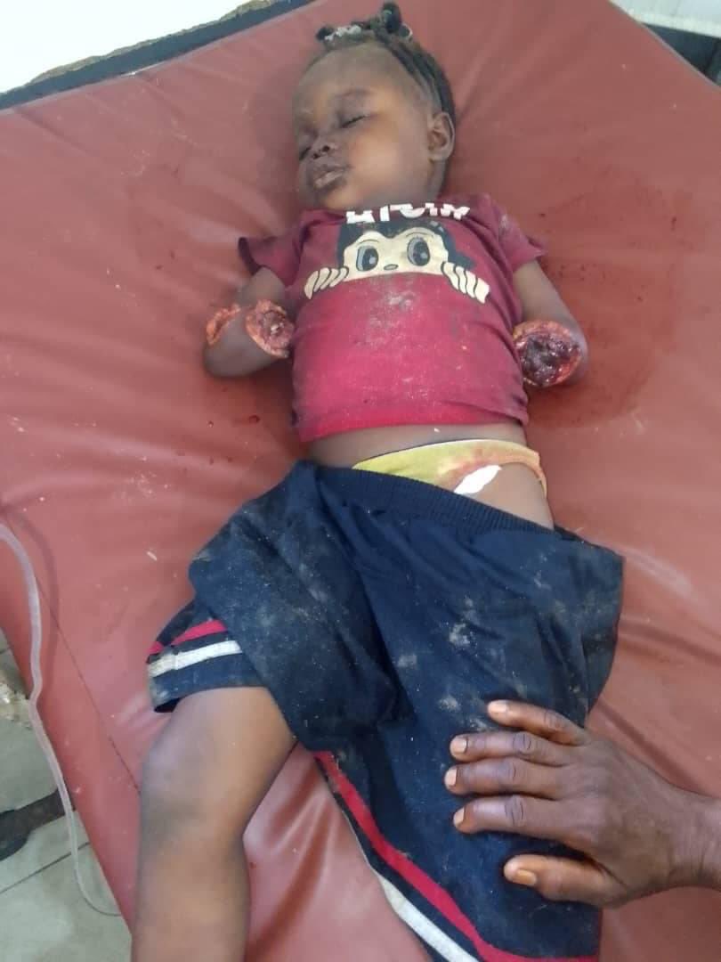 NAcacia's tweet photo. @PatrickMuyaya @kassamba01 Regardez cette cruauté dans la Tshopo chère ministre ! Une petite fille de 3ans ! Pourquoi tout ça ? Pourquoi vraiment ??? https://t.co/xGcB1RKFJq