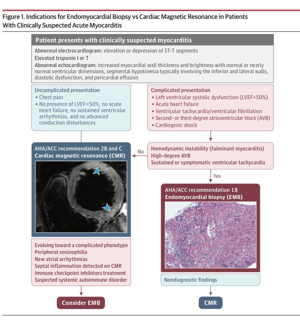Myocarditis, Diagnosis and Treatment: a nice summary. 📚 JAMA 2023 ♥️

#Cardiology #CardioX #CardioEd