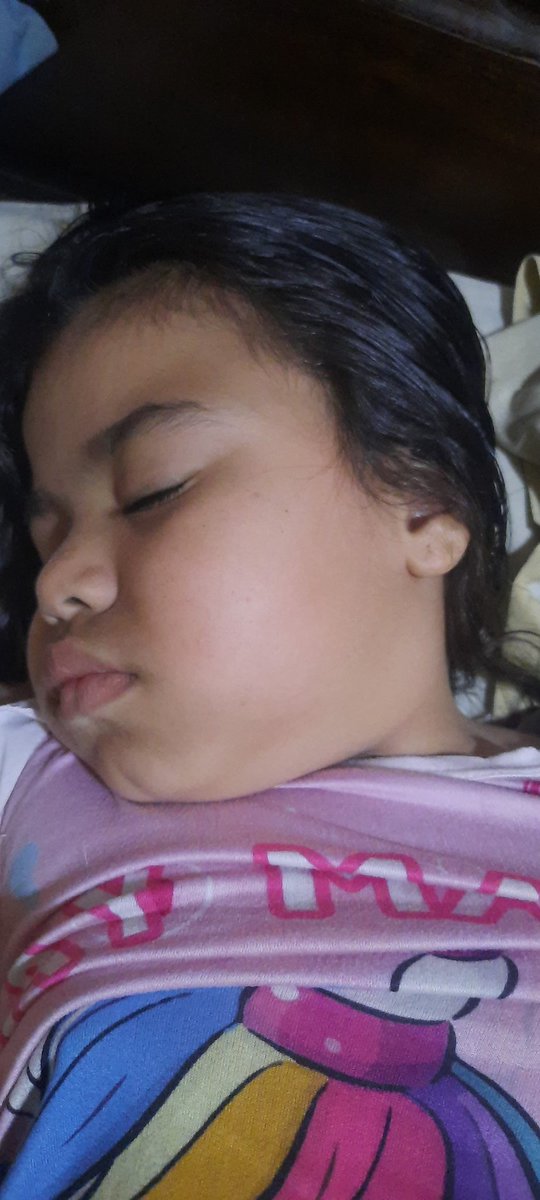 mariani87784922's tweet image. Tengo ojeras d no dormir bien😭 por favor les ruego m AYUDEN para adquirir mis tratamientos el anticonvulsivo cada 3 días s m termina y lo he tomado intermitentemente ,la amp d pubertad es d alto costo faltan $350 cada aporte suma.
pm
04245649764
17659326
mercantil