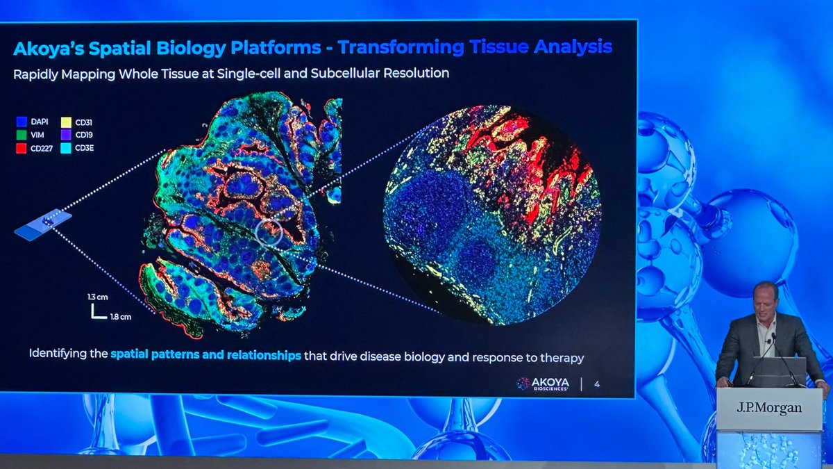 AkoyaBio's tweet photo. Here is an update of the highlights and vision shared by our CEO, Brian McKelligon, at #JPM24. https://t.co/khy482vw4n.
If you missed his presentation, you can catch up on the key points and learn more about the future of #AkoyaBio in 2024.
#JPM2024 #SpatialBiology #Biotech https://t.co/FaHcuJ2IUb