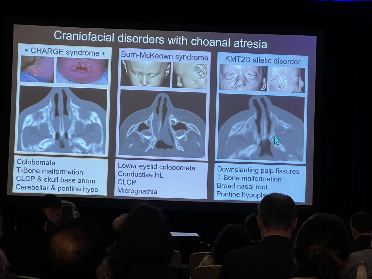 @callyrobs from @boschildrensrad shows us the complex and rare craniofacial anomalies. #ASPNR24 #pedineurorad